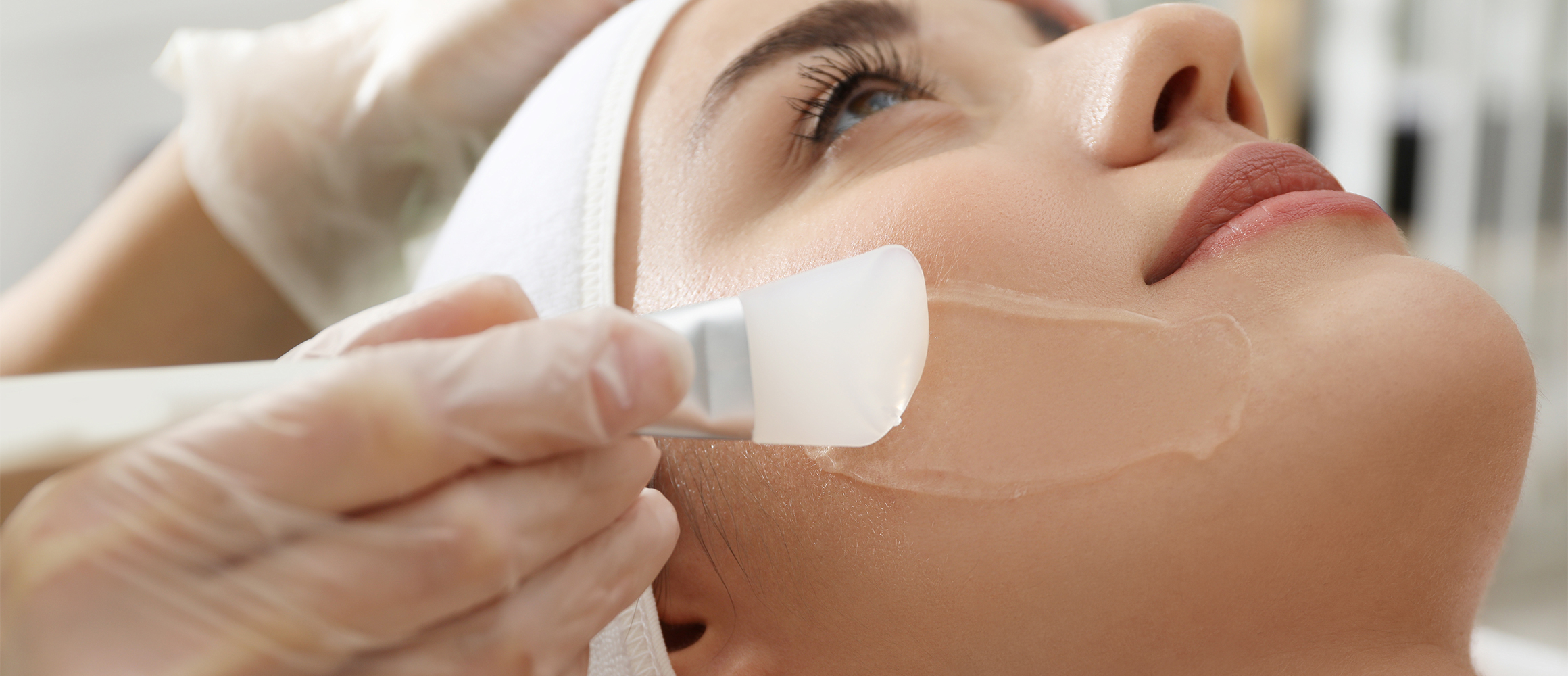 chemical peel for dark spots