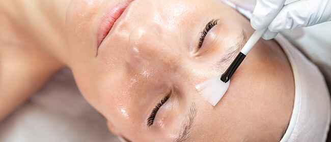 Anti Acne Peel