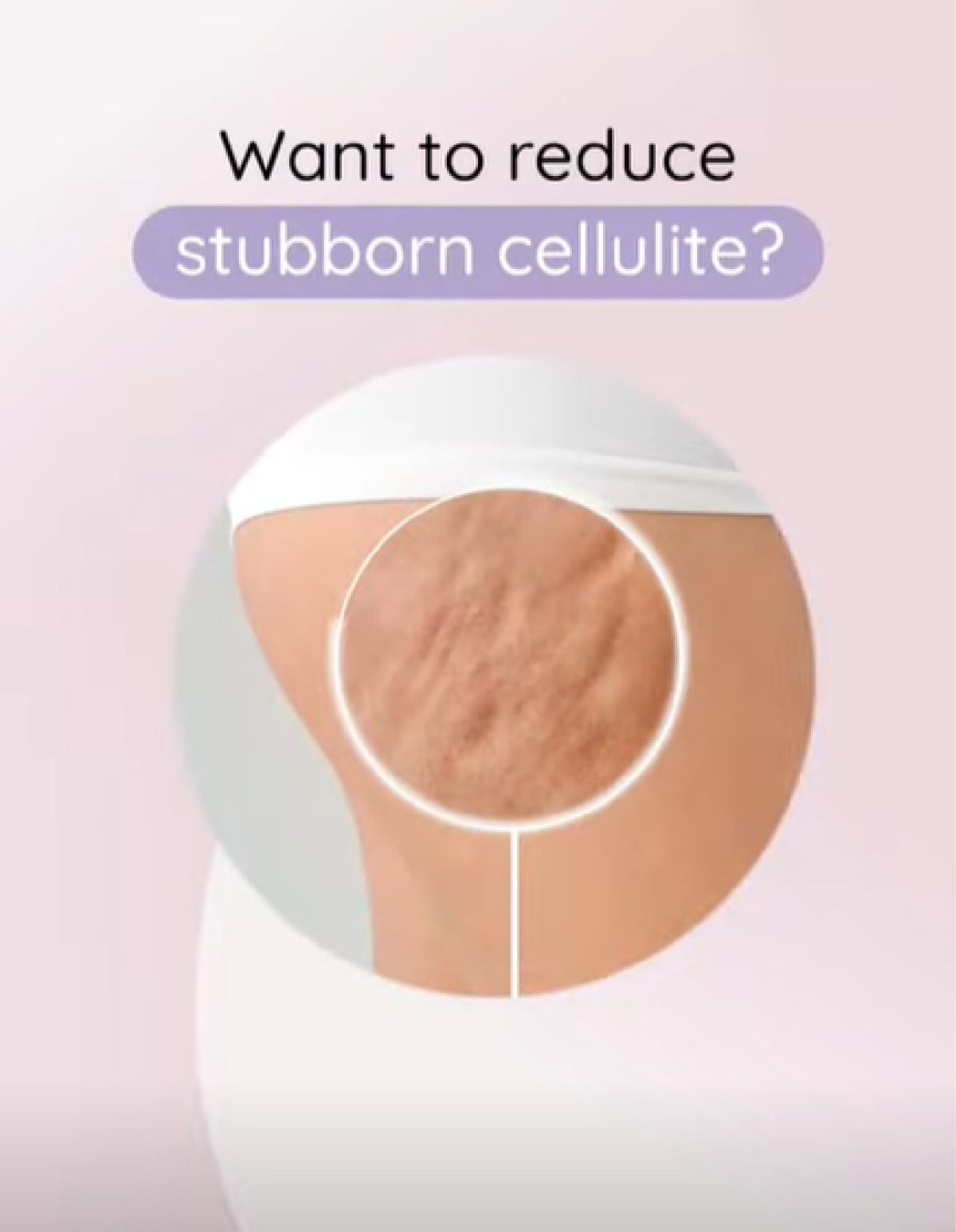 Teas To End Cellulite _ The 5 Best Products to End Cellulite! SweetCare ...